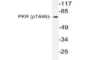 Western blot (WB) analyzes of p-PKR (pThr446) antibody in extracts from NIH-3T3 IFN cells. (EIF2AK2 anticorps  (pThr446))