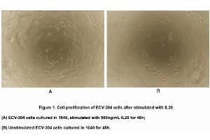 Image no. 3 for Interleukin 20 (IL20) (AA 25-176) (Active) protein (His tag) (ABIN6239769)