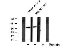 Western blot analysis of I kappaB alpha phosphorylation expression in mouse muscle and mouse brain lysates,The lane on the right is treated with the antigen-specific peptide. (NFKBIA anticorps  (pTyr305))