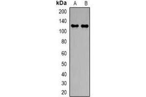 Western blot analysis of NBC1 expression in PC3 (A), A549 (B) whole cell lysates. (SLC4A4 anticorps)