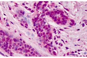 Human Breast: Formalin-Fixed, Paraffin-Embedded (FFPE)