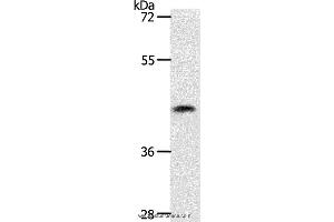 Western blot analysis of 231 cell, using PLAT Polyclonal Antibody at dilution of 1:450 (PLAT anticorps)