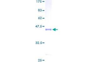 Image no. 1 for Calmodulin Like Protein 3 (CALML3) (AA 1-149) protein (GST tag) (ABIN1347895)