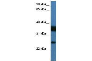 WB Suggested Anti-ZMAT2 Antibody Titration:  0.