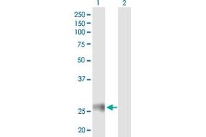 Western Blot analysis of HLA-DRB4 expression in transfected 293T cell line by HLA-DRB4 MaxPab polyclonal antibody.