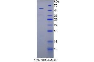 SDS-PAGE (SDS) image for Peroxiredoxin 1 (PRDX1) (AA 1-199) protein (His tag,GST tag) (ABIN2123456)