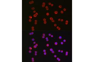Immunofluorescence analysis of HT-29 cells using CFTR Rabbit pAb (ABIN6129855, ABIN6138469, ABIN6138470 and ABIN6224429) at dilution of 1:150 (40x lens). (CFTR anticorps  (AA 1161-1480))