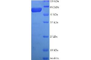 SDS-PAGE (SDS) image for Premelanosome Protein (PMEL) (AA 25-467) protein (His tag) (ABIN5713832)