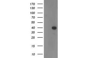 Western Blotting (WB) image for anti-Reticulon 4 Interacting Protein 1 (RTN4IP1) antibody (ABIN1500772) (RTN4IP1 anticorps)