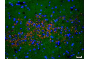 Formalin-fixed and paraffin-embedded rat brain labeled with Anti-Phospho-NMDAR1(Ser890) Polyclonal Antibody, Unconjugated (ABIN744278) 1:200, overnight at 4°C, The secondary antibody was Goat Anti-Rabbit IgG, Cy3 conjugated used at 1:200 dilution for 40 minutes at 37°C. (GRIN1/NMDAR1 anticorps  (pSer890))