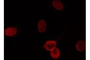 ABIN6274197 staining HuvEc cells by IF/ICC.