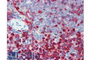 Immunohistochemistry staining of human spleen (paraffin sections) using anti-CD18 (Commercially tested by LifeSpan BioSciences. (Integrin beta 2 anticorps  (PE))