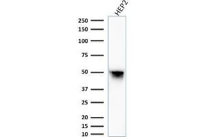 Western Blot Analysis of HEP2 cell lysate using Vimentin Mouse Monoclonal Antibody (VM1170). (Vimentin anticorps)