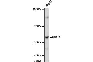 Western blot analysis of extracts of HepG2 cells, using HNF1B antibody (ABIN3017358, ABIN3017359, ABIN3017360, ABIN1680315 and ABIN1680316) at 1:1000 dilution. (HNF1B anticorps  (AA 100-200))