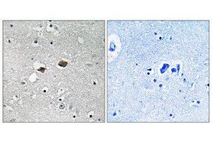 Immunohistochemistry (IHC) image for anti-Tigger Transposable Element Derived 3 (TIGD3) (C-Term) antibody (ABIN1852280) (TIGD3 anticorps  (C-Term))