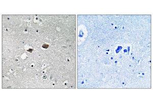 Immunohistochemistry (IHC) image for anti-Tigger Transposable Element Derived 3 (TIGD3) (C-Term) antibody (ABIN1852280) (TIGD3 anticorps  (C-Term))