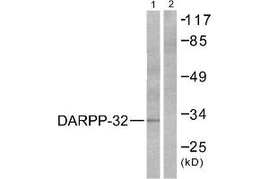 Western Blotting (WB) image for anti-Protein Phosphatase 1, Regulatory (Inhibitor) Subunit 1B (PPP1R1B) (Thr75) antibody (ABIN1847886) (DARPP32 anticorps  (Thr75))