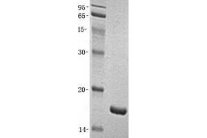 Validation with Western Blot (FABP2 Protéine)
