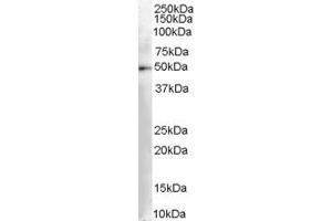 Western Blotting (WB) image for anti-Dopa Decarboxylase (Aromatic L-Amino Acid Decarboxylase) (DDC) (AA 464-475) antibody (ABIN295679) (DDC anticorps  (AA 464-475))