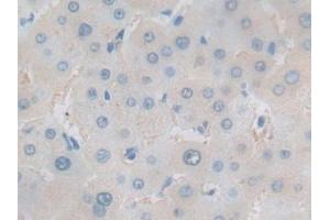 Detection of HSF1 in Human Liver Tissue using Polyclonal Antibody to Heat Shock Transcription Factor 1 (HSF1)