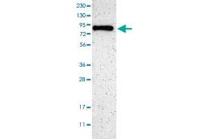 Western blot analysis of Human cell line RT-4 with SH3BP1 polyclonal antibody  at 1:100-1:250 dilution. (SH3BP1 anticorps)