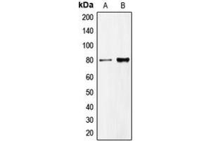 Western blot analysis of CD318 expression in HeLa (A), DU145 (B) whole cell lysates. (CDCP1 anticorps  (C-Term))
