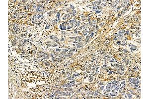 anti-FRY-Like (FRYL) antibody