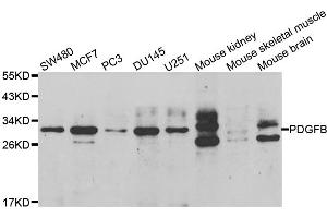 Western blot analysis of extracts of various cell lines, using PDGFB antibody. (PDGFB anticorps)
