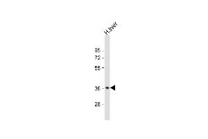 Anti-CTBS Antibody (N-Term) at 1:2000 dilution + human liver lysate Lysates/proteins at 20 μg per lane. (CTBS anticorps  (AA 85-119))