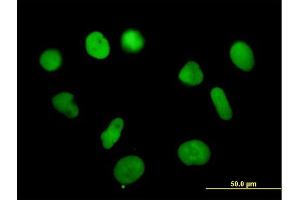 Immunofluorescence of purified MaxPab antibody to RPA3 on HeLa cell. (RPA3 anticorps  (AA 1-121))
