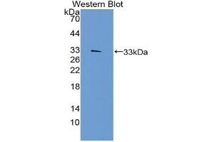 Detection of Recombinant TEP1, Human using Polyclonal Antibody to Telomerase protein component 1 (TEP1) (TEP1 anticorps  (AA 2368-2627))