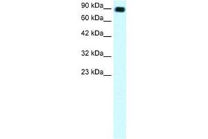 Human Daudi; WB Suggested Anti-C13ORF8 Antibody Titration: 1. (ZNF828 anticorps  (Middle Region))