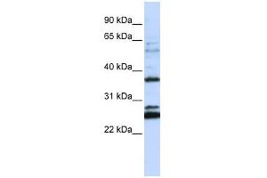 FAM70A antibody used at 1 ug/ml to detect target protein. (FAM70A anticorps  (N-Term))