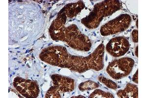 anti-Chromosome 1 Open Reading Frame 50 (C1ORF50) antibody