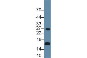 Detection of AQP2 in Human 293T cell lysate using Polyclonal Antibody to Aquaporin 2, Collecting Duct (AQP2) (AQP2 anticorps  (AA 177-271))