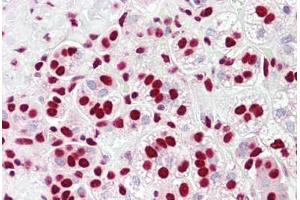 Anti-HnRNP K antibody IHC staining of human adrenal. (HNRNPK anticorps  (AA 200-250))