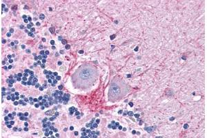 Human Brain, Cerebellum: Formalin-Fixed, Paraffin-Embedded (FFPE)