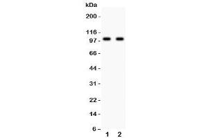 Western blot testing of GLUR4 antibody and Lane 1:  rat brain (GRIA4 anticorps  (AA 176-350))