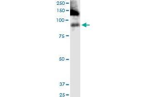 ITGB2 monoclonal antibody (M03), clone 3C7. (Integrin beta 2 anticorps  (AA 1-769))