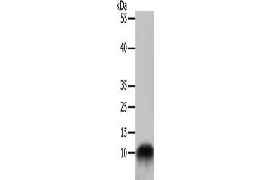 Gel: 10+15 % SDS-PAGE, Lysate: 50 μg, Lane: 293T cells, Primary antibody: ABIN7129018(COX7B Antibody) at dilution 1/700, Secondary antibody: Goat anti rabbit IgG at 1/8000 dilution, Exposure time: 30 seconds (COX7B anticorps)