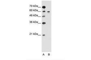 Image no. 1 for anti-Tyrosinase (TYR) (AA 321-370) antibody (ABIN205038) (TYR anticorps  (AA 321-370))