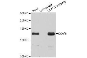 Immunoprecipitation analysis of 200ug extracts of HeLa cells using 3ug CCAR1 antibody. (CCAR1 anticorps  (AA 1-200))