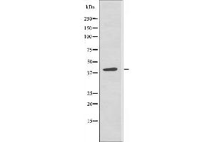 Western blot analysis of extracts from 293 cells, using PTX3 antibody. (PTX3 anticorps  (N-Term))