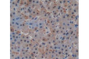 Used in DAB staining on fromalin fixed paraffin- embedded Kidney tissue