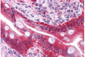 Human Small Intestine: Formalin-Fixed, Paraffin-Embedded (FFPE)