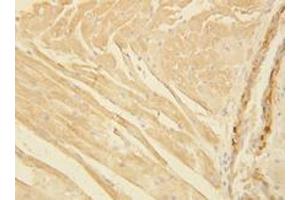 Actin Polyclonal Antibody