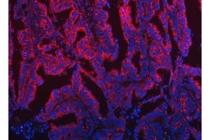 IF analysis of TOM1L1 using anti-TOM1L1 antibody (ABIN7602631). (TOM1L1 anticorps  (AA 9-448))