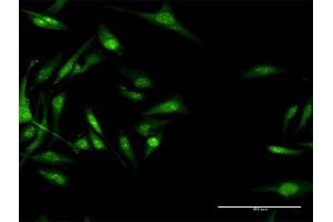 Immunofluorescence of purified MaxPab antibody to CACNB3 on HeLa cell. (CACNB3 anticorps  (AA 1-484))