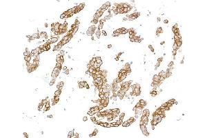 Immunocytochemistry (ICC) image for anti-Syndecan 1 (SDC1) (AA 23-251) antibody (ABIN7795741)