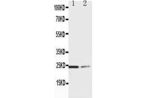 Anti-SOCS1 antibody, Western blotting Lane 1:  Cell Lysate Lane 2: COLO320 Cell Lysate (SOCS1 anticorps  (C-Term))
